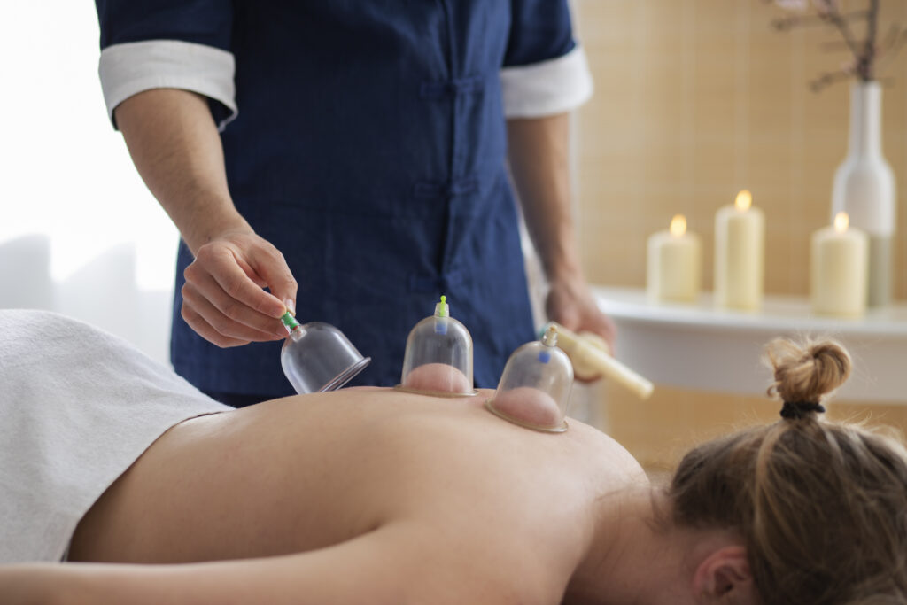 cupping therapist